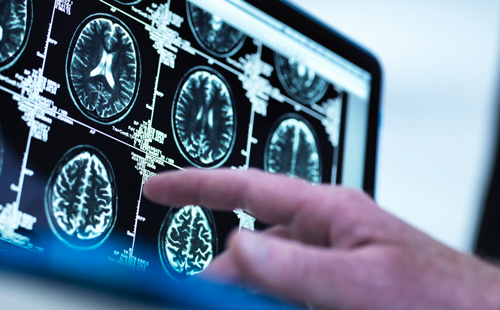 image of finger pointing at brain scan image